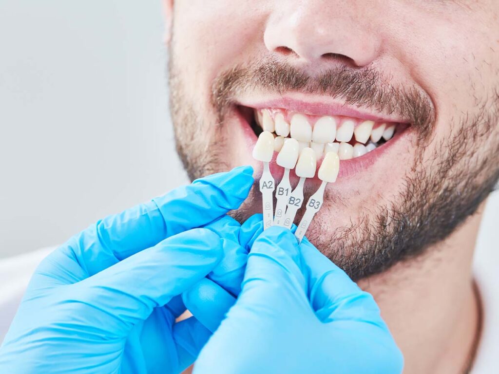 Dentist matching color samples to persons teeth