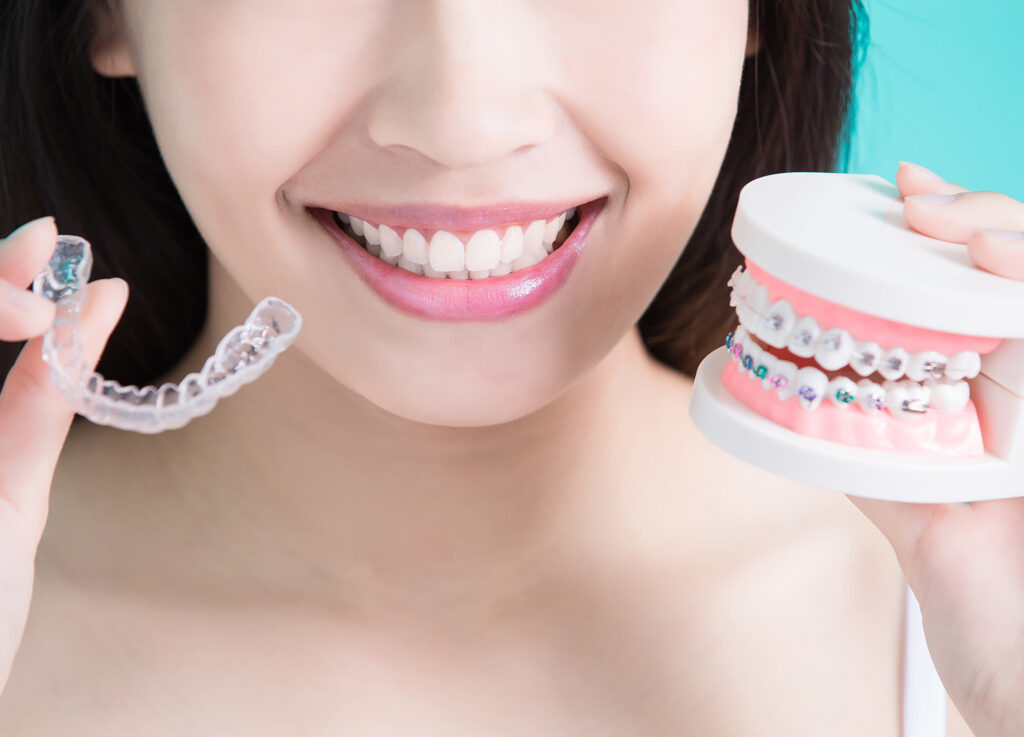 woman with traditional braces and invisible aligners
