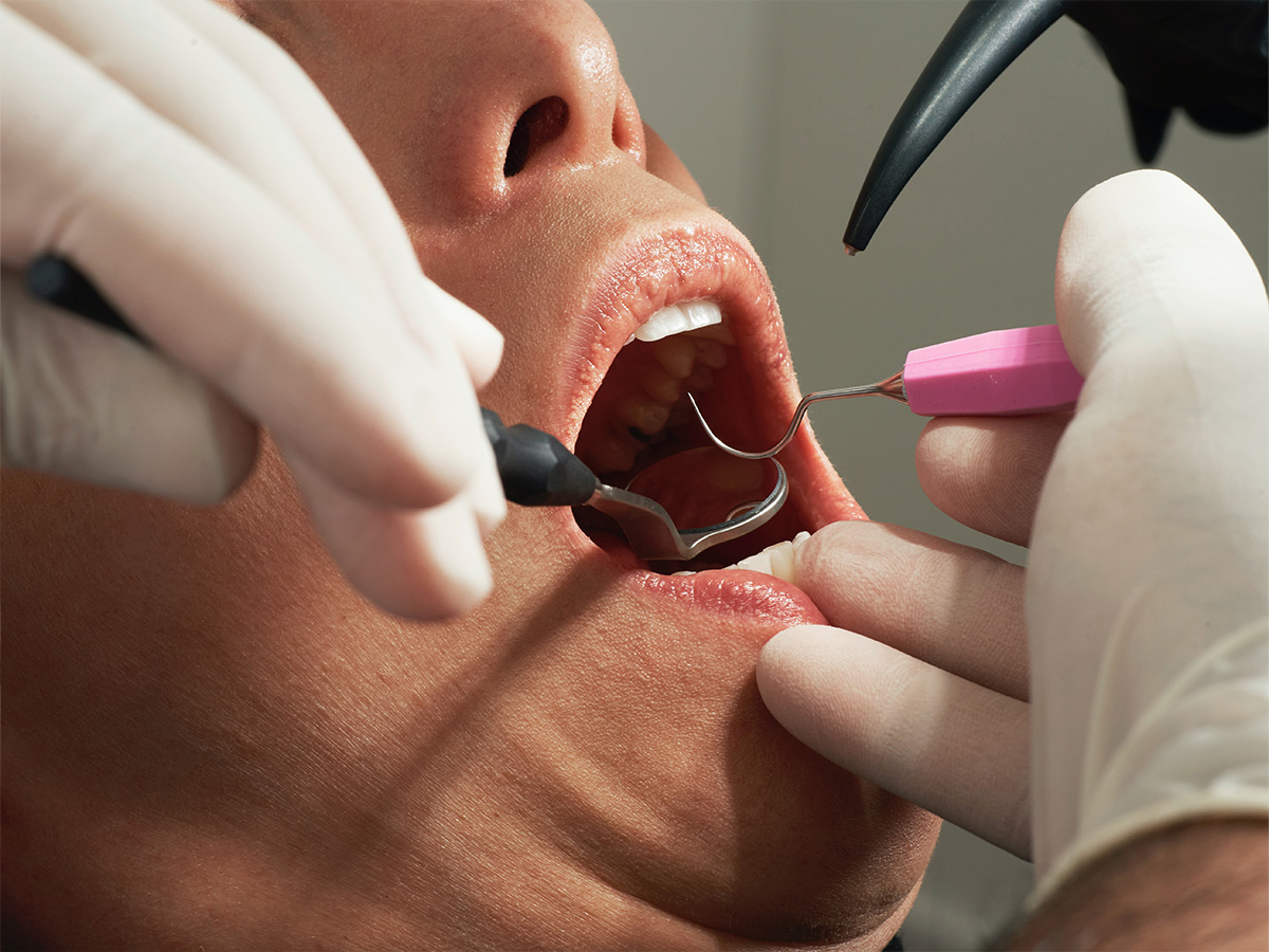person getting teeth cleaned
