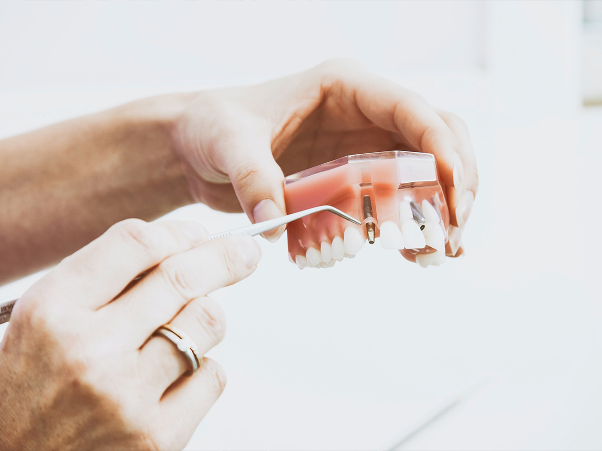 doctor showing a root canal