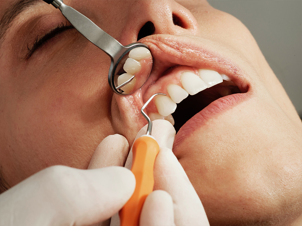 clen healthy teeth
