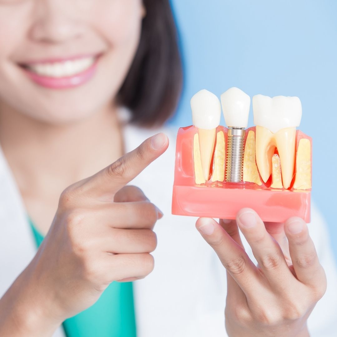 dentist with model of dental implants