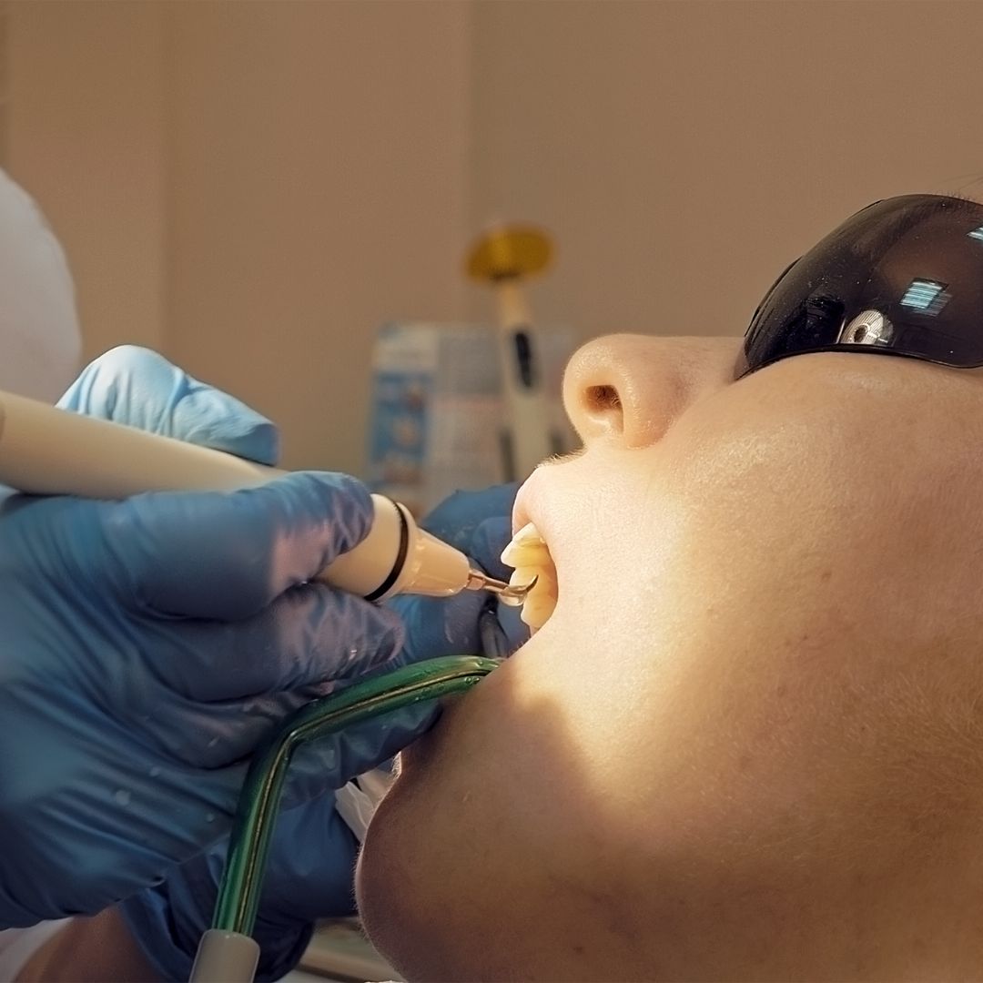 Comfortable person getting teeth cleaned with sunglasses on