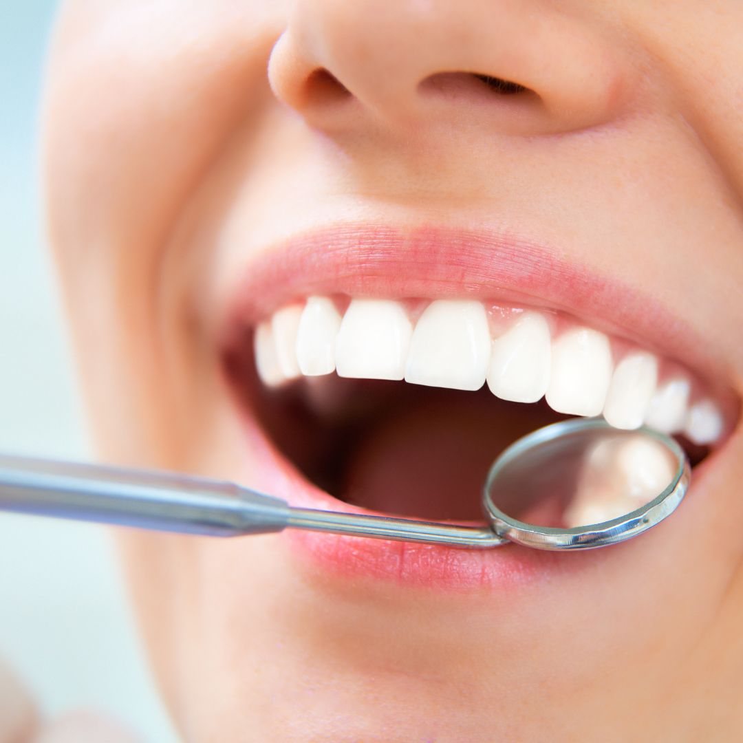 dentists mirror in mouth