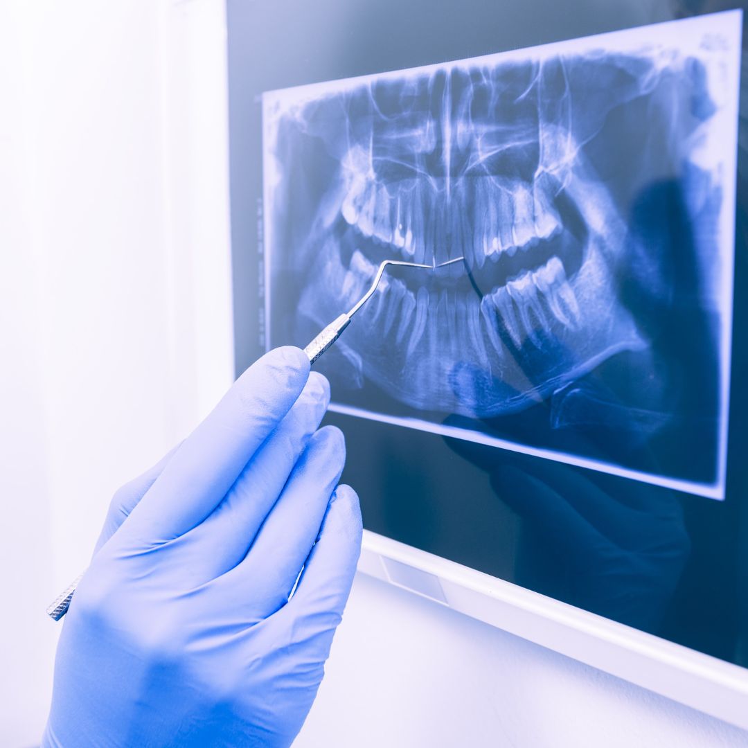 dental X-ray