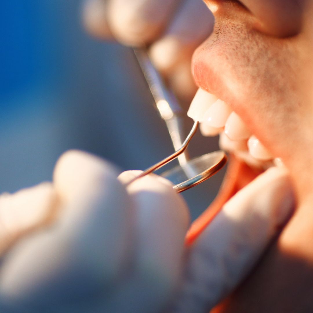 dental examination