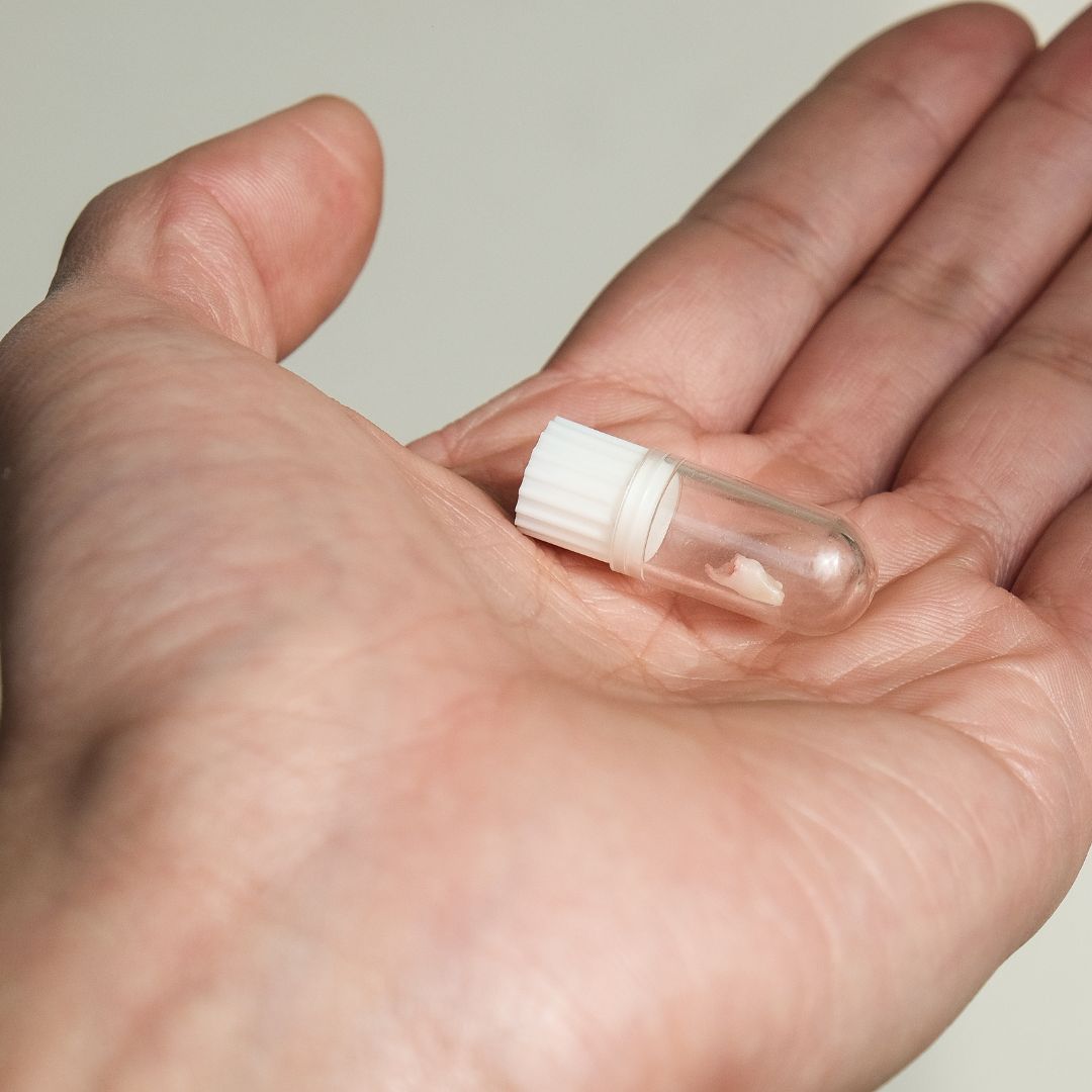 knocked out tooth in capsule