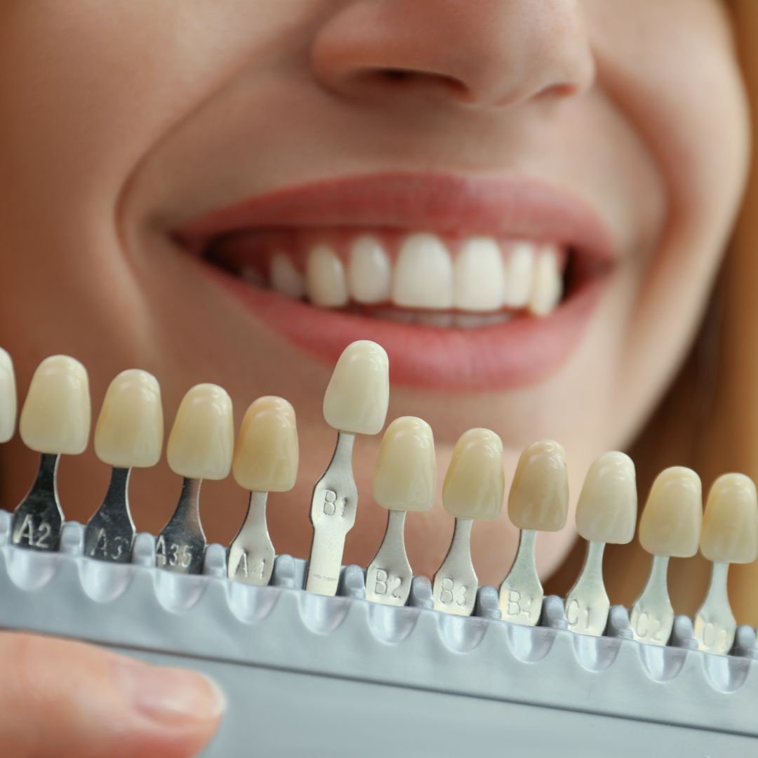 tooth whitening display