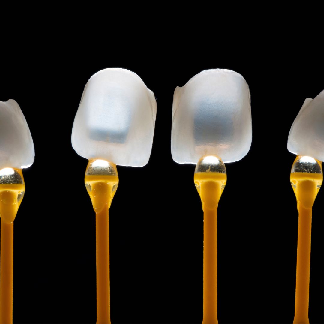 veneers