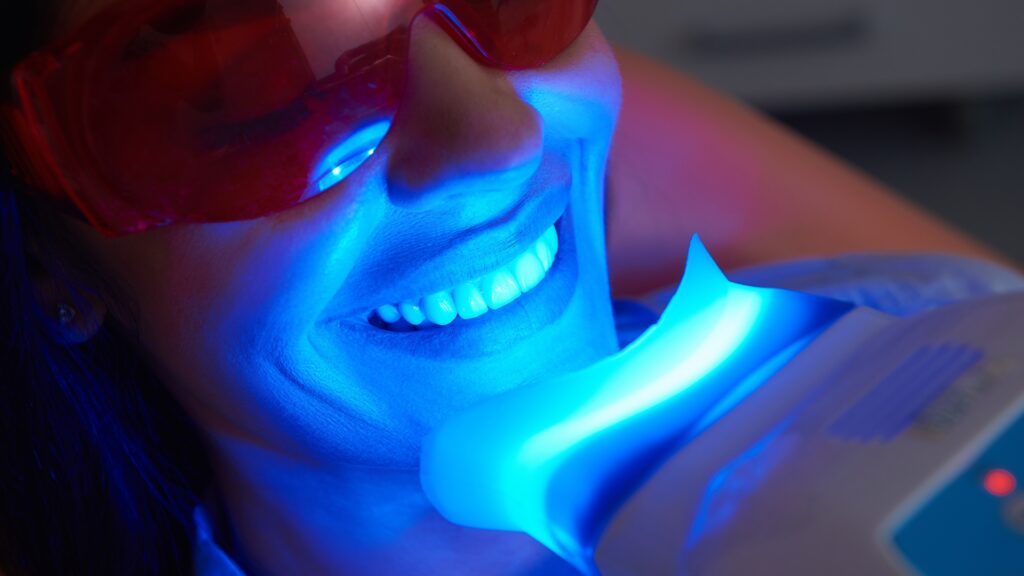 image of teeth whitening