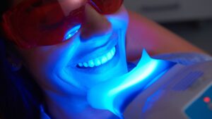 image of teeth whitening
