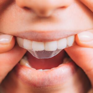 image of teeth whitening strips