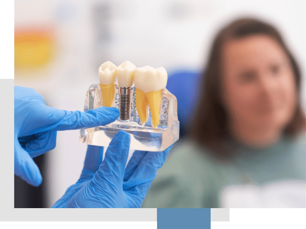 Implant Restorations_IMG-1
