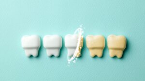 white teeth and yellow teeth