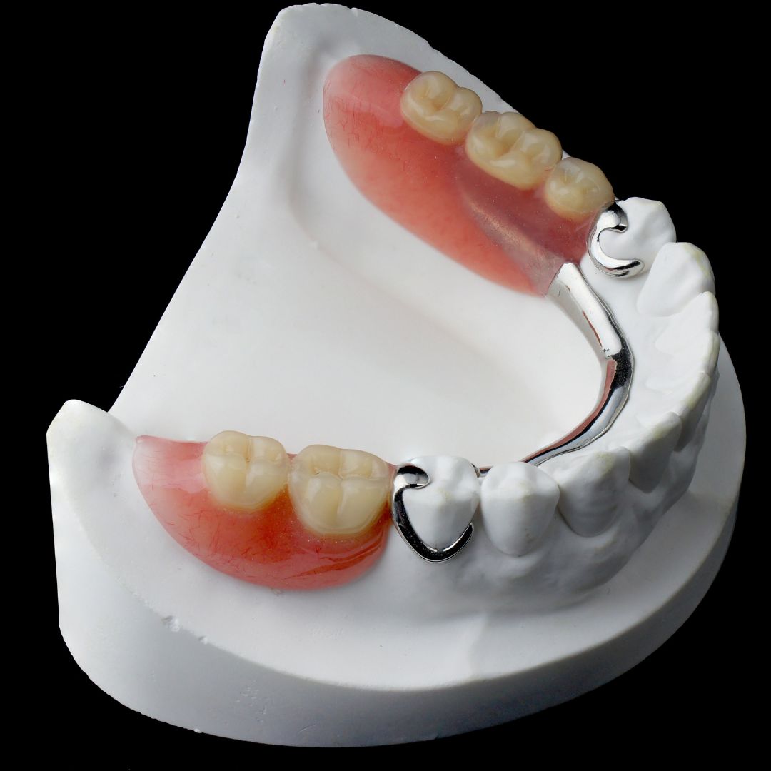 Partial dentures