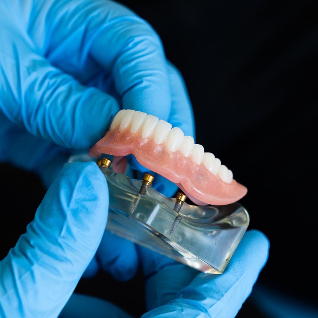 Full dentures