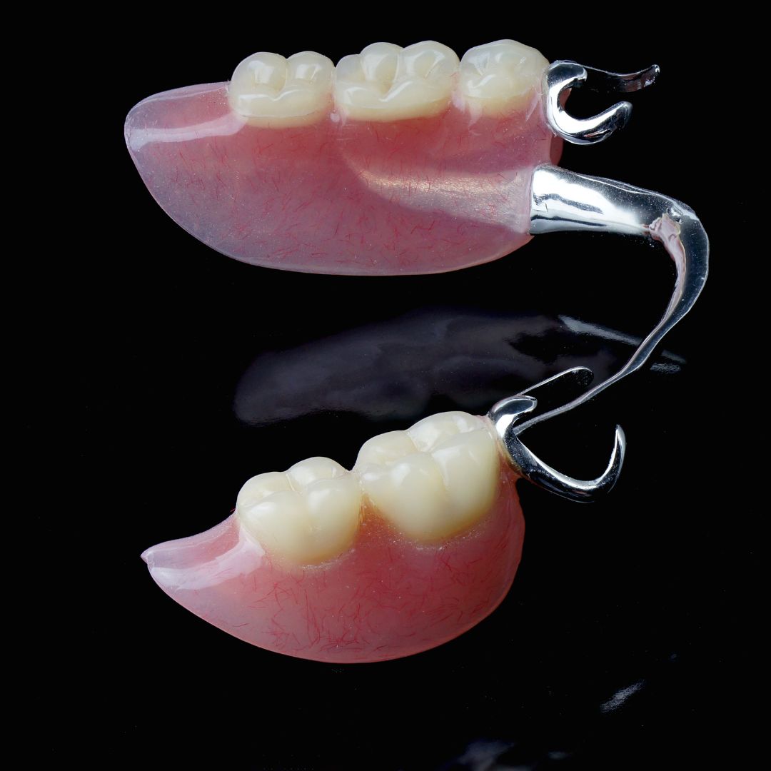 Partial dentures