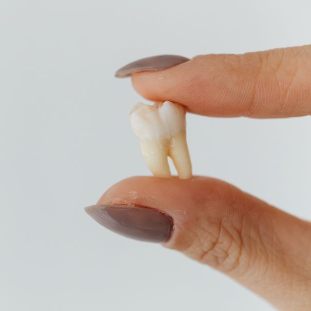 Holding a loose tooth between fingers