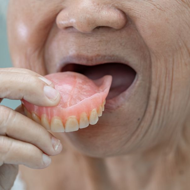 Elderly woman putting dentures in