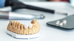 Dentures.