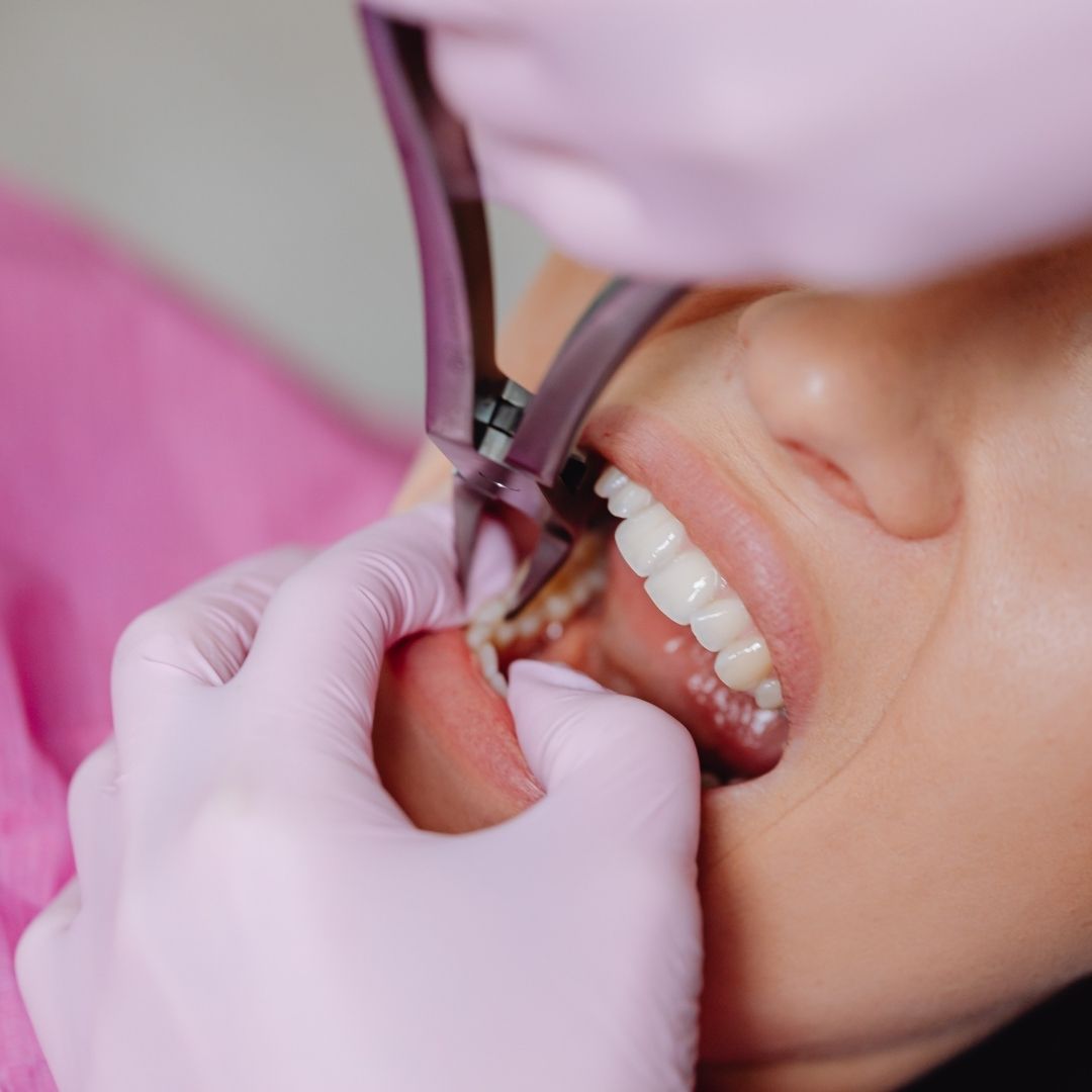 routine dental visit