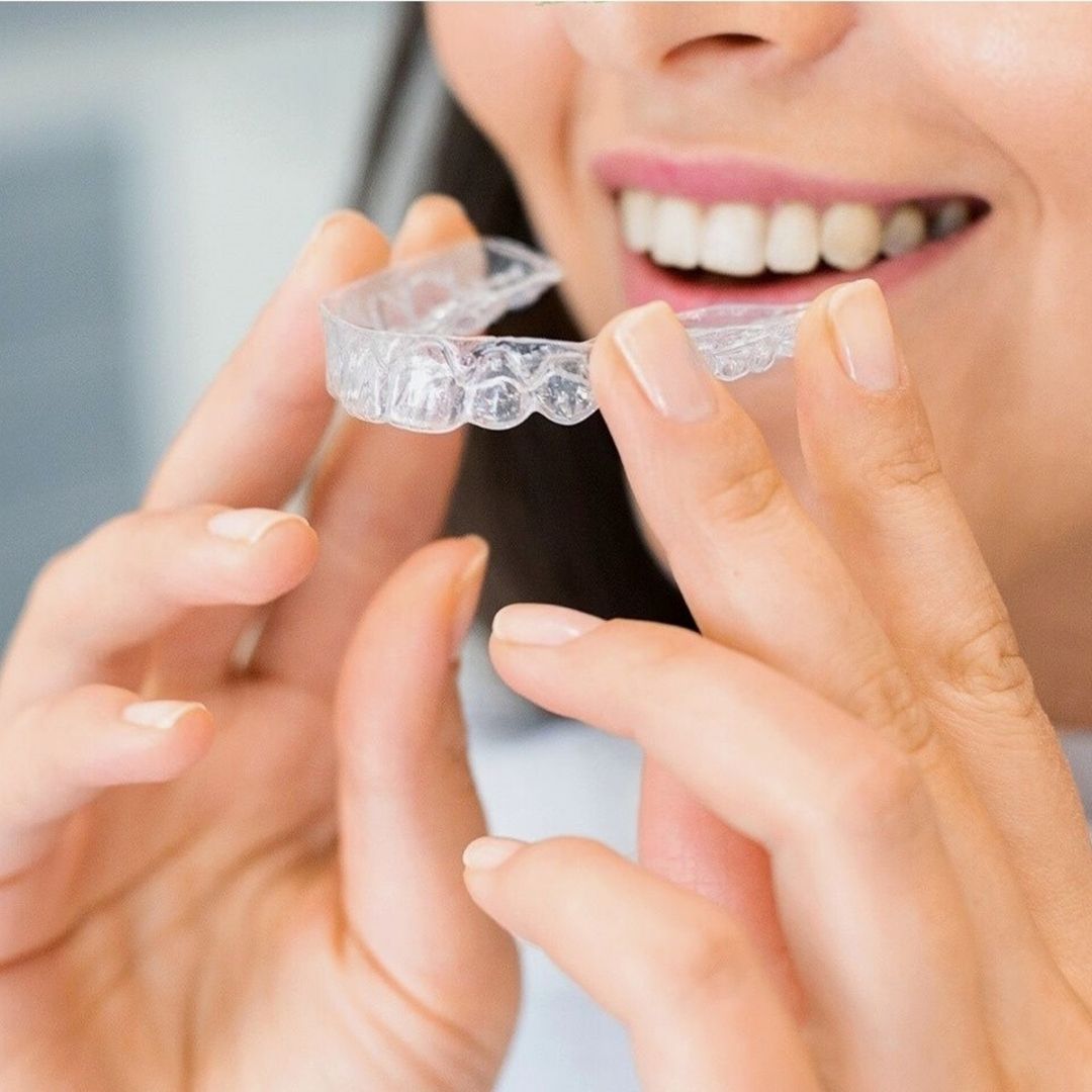 clear aligners